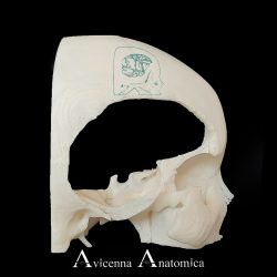 مولاژ سه‌بعدی آناتومیکی OrbitoZygomatic Approach برای تمرین و آموزش تکنیک کرانیوتومی - مناسب برای رزیدنت‌ها و متخصصان جراحی مغز و اعصاب