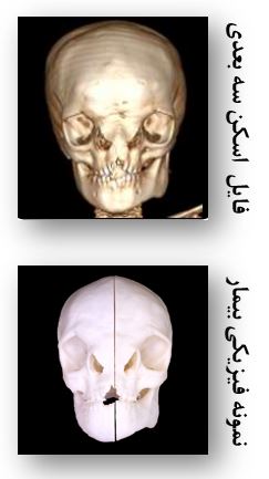 ساخت نمونه فیزیکی ضایعه بیمار